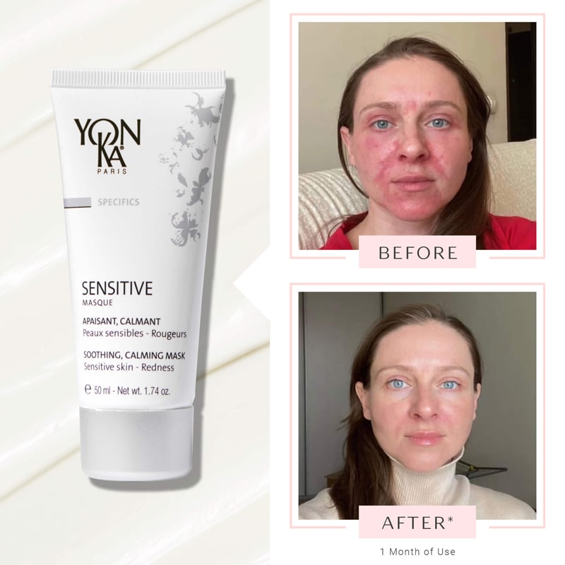 Before and after shot of model after 1 month use of Yon-Ka Paris Sensitive Mask