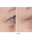 Close up of area around eye showing baseline and 2 weeks use results of Le Prunier Plum Beauty Oil
