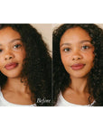 Roz Foundation Mask - model shown before and after use of product