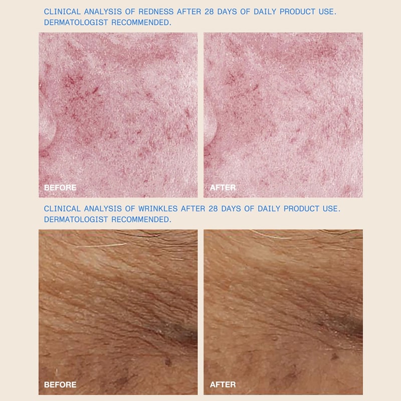 DUNE Suncare The Mug Guard - clinical analysis of product shown before and after product use