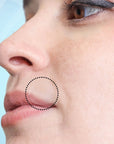 Close up of SMARTMED Smart Cold Sore Treatment Patch with Honey shown above lip on model