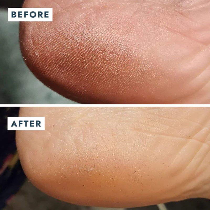 Before and after use on heel of VOESH New York Heel Repair Duo