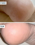 Before and after use on heel of VOESH New York Heel Repair Duo