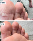 Before and after use on bottom of feet/toes of VOESH New York Heel Repair Duo