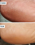 Before and after use on heel of VOESH New York Heel Repair Duo