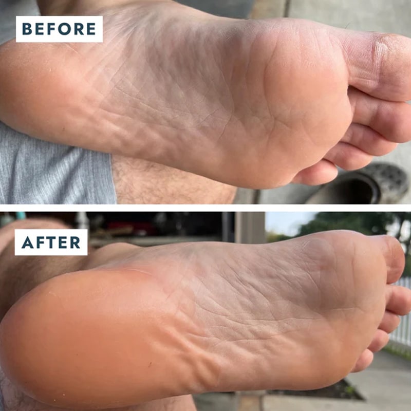 Before and after use on bottom of foot of VOESH New York Heel Repair Duo