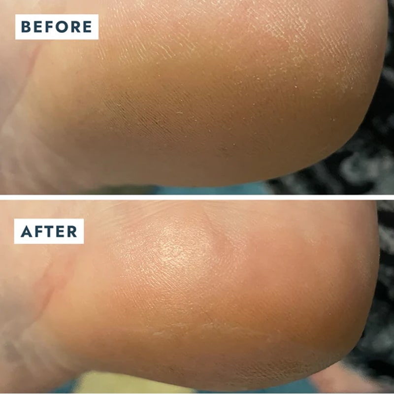 Before and after use on heel of VOESH New York Heel Repair Duo