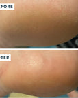 Before and after use on heel of VOESH New York Heel Repair Duo